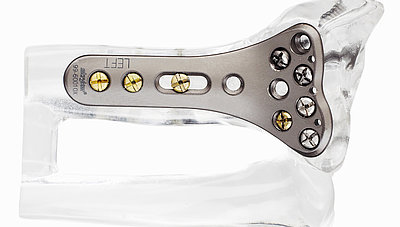 Stryker uses BLUM Measuring Components for production of implants to bone joints