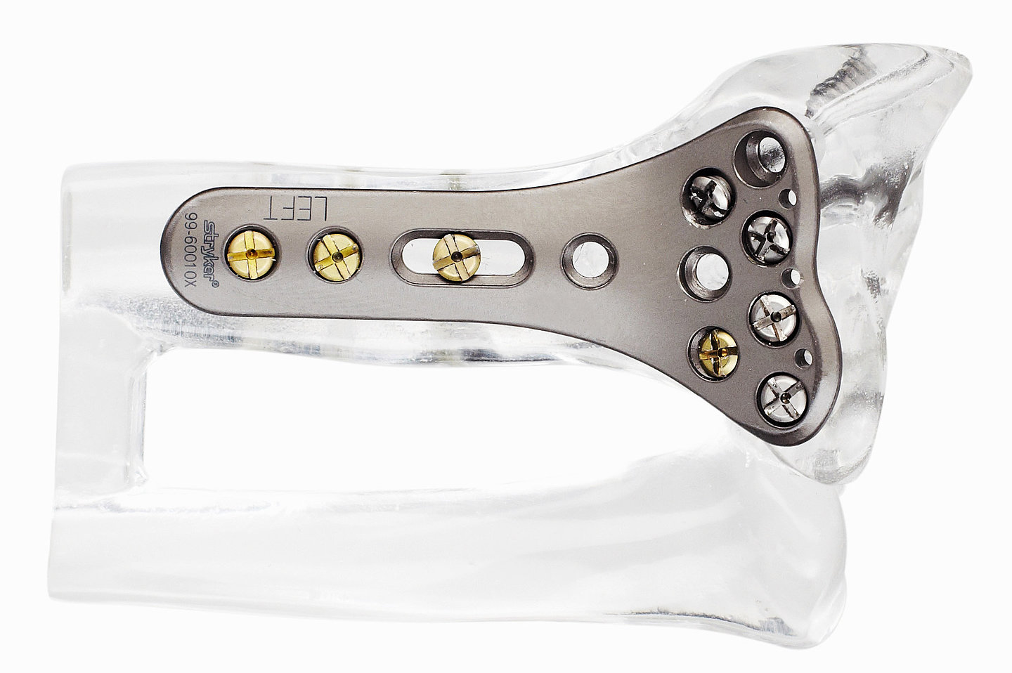 Stryker uses BLUM Measuring Components for production of implants to bone joints